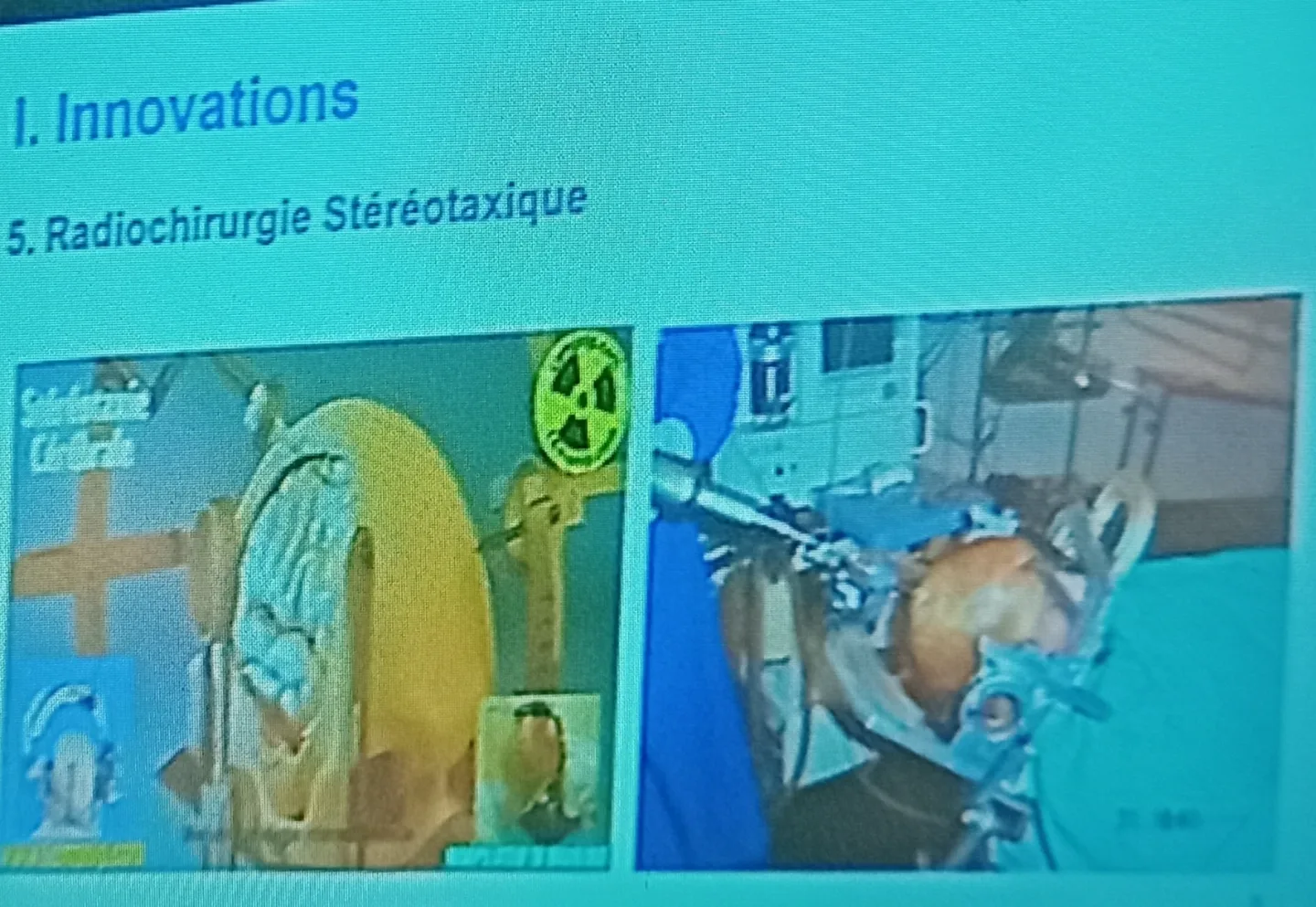 Neurochirurgie en Afrique : innovations, transmission et coopération au cœur du congrès de Yaoundé